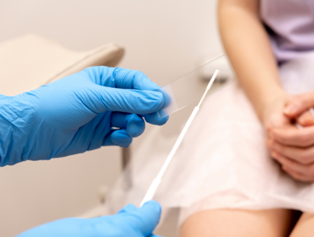 Vaginalne infekcije: Zašto je žensko zdravlje ugroženije ljeti? 