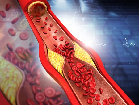 Kolesterol i trigliceridi: Kada je srce ugroženo?