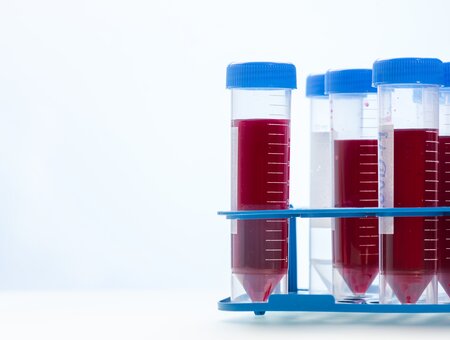  Što su krvne grupe i što one znače?