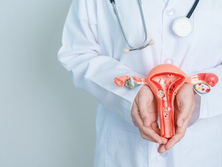 Što je to endometrioza i kako ju prepoznati?