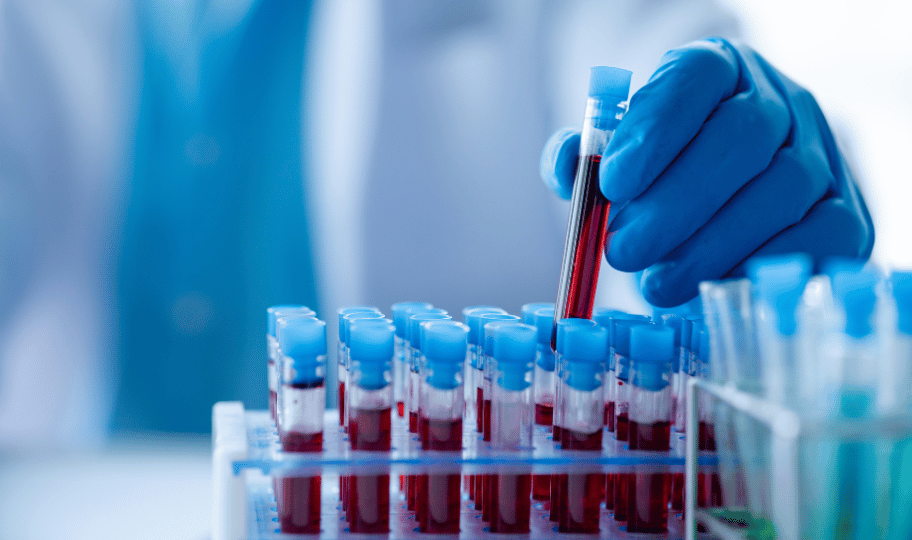 Ampule krvi i laboratorijski tehničar koji u ruci drži jednu od njih, nalaz krvi