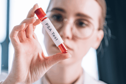Zdravstvena djelatnica drži ampulu na kojoj piše PSA test