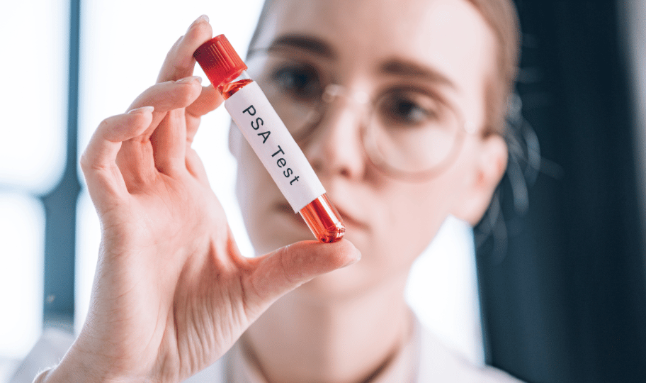 Zdravstvena djelatnica drži ampulu na kojoj piše PSA test