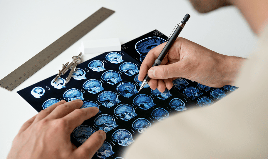 liječnik pregledava nalaz magnente rezonance mozga