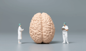 model mozga i figurice liječnika