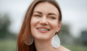 nasmijana žena s aparatićem za zube