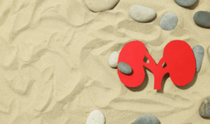 papirnati model bubrega na pješčanoj plaži, bubrežni kamenac