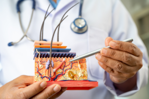 krupni kadar ruku liječnika u kojima drži model kože i objašnjava slojeve kože