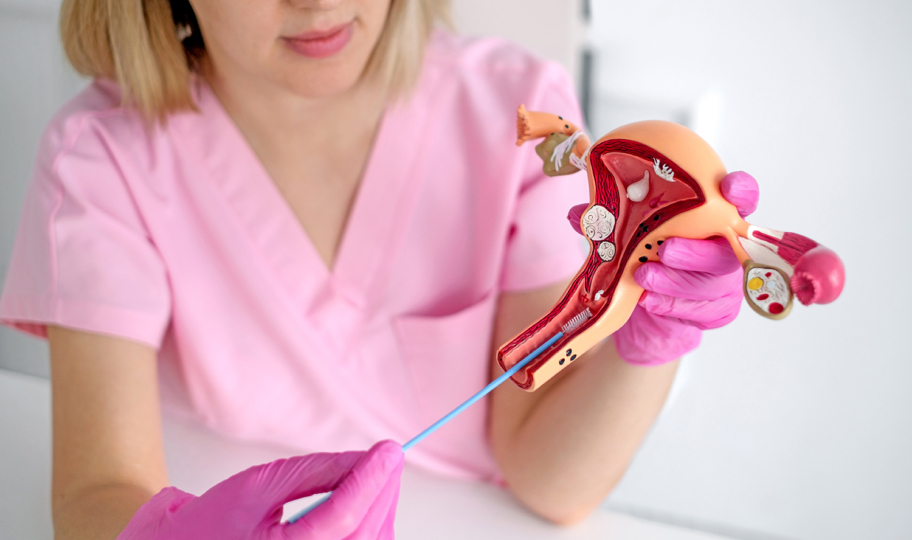 ginekologinja demonstrira uzimanje uzorka za papa test na modelu ženske maternice