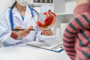 liječnica pacijentu u ordinaciji pokazuje model želuca