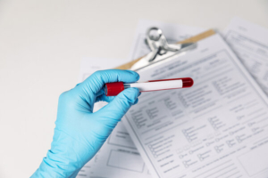 laboratorijski tehničar ispituje krvnu grupu uzorka