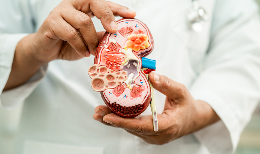 liječnik drži model ljudskog bubrega u rukama, kronična bolest bubrega
