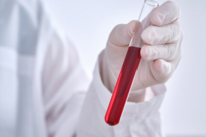 laboratorijski tehničar drži ampulu krvi