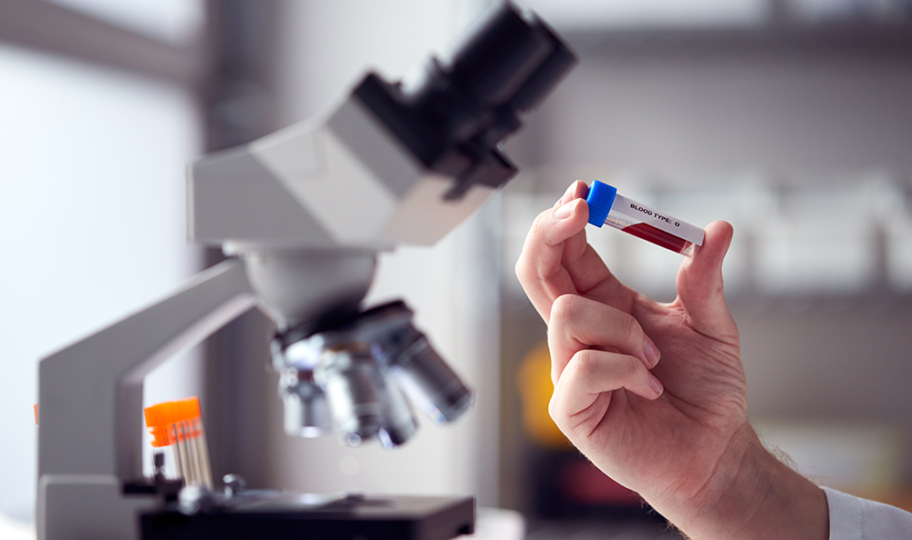 laboratorijski tehničar drži ampulu krvi