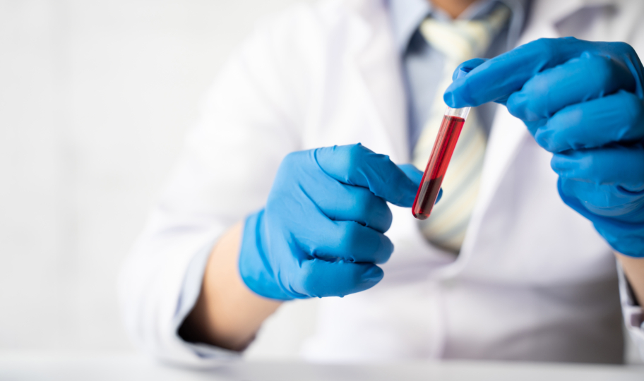 krupni kadar tehničara u laboratorijukoji drži uzorak krvi