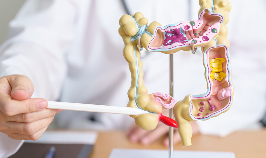 krupni kadar liječnika s modelom ljudskih crijeva