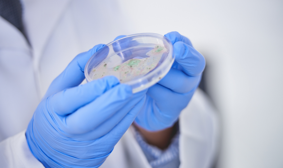 krupni kadar laboratorijskog tehničara koji u rukama drži petrijevu zdjelicu s kulturom