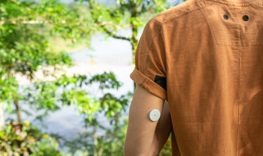 osoba sa senzorom za kontinuirano mjerenje glukoze na nadlaktici