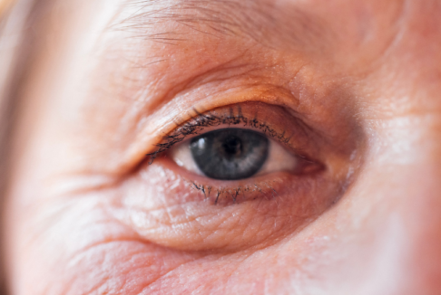 krupni kadar oka sa spuštenim vjeđama