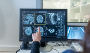 nalaz magnetne rezonance na monitoru računala