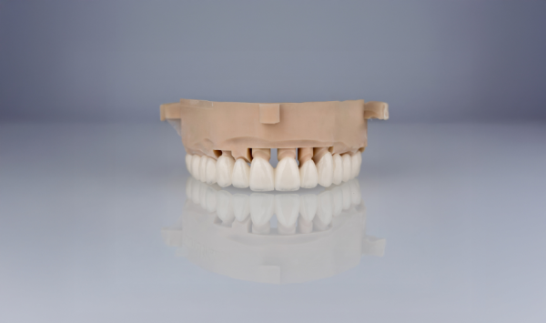 umjetno zubalo s gotovim zubnim krunicama