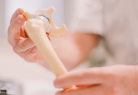 liječnik drži model kuka