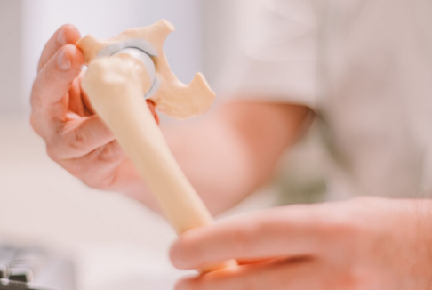 liječnik drži model kuka