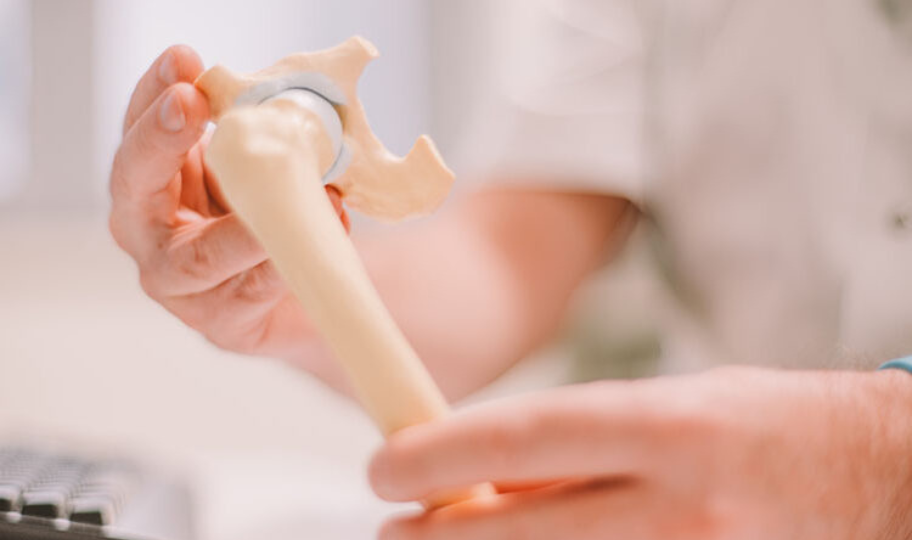 liječnik drži model kuka