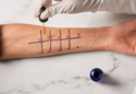 prick test na alergije