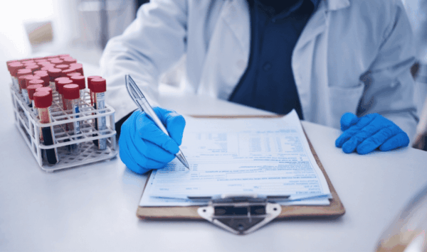 laboratorijski tehničar radi nalaz jetrenih enzima