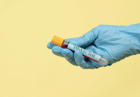 ruka u lateks rukavici drži epruvetu na kojoj piše hbaic test