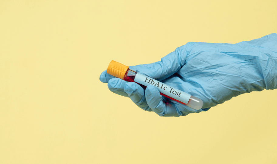 ruka u lateks rukavici drži epruvetu na kojoj piše hbaic test